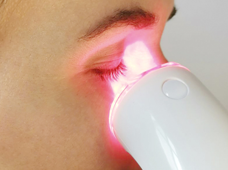 Лечение близорукости красным светом - новая надежда в борьбе с миопией